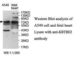 Anti-KBTBD2 Antibody
