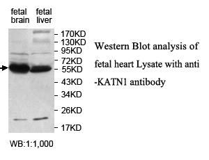 Anti-KATNA1 Antibody