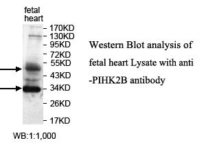 Anti-PIP4K2B Antibody