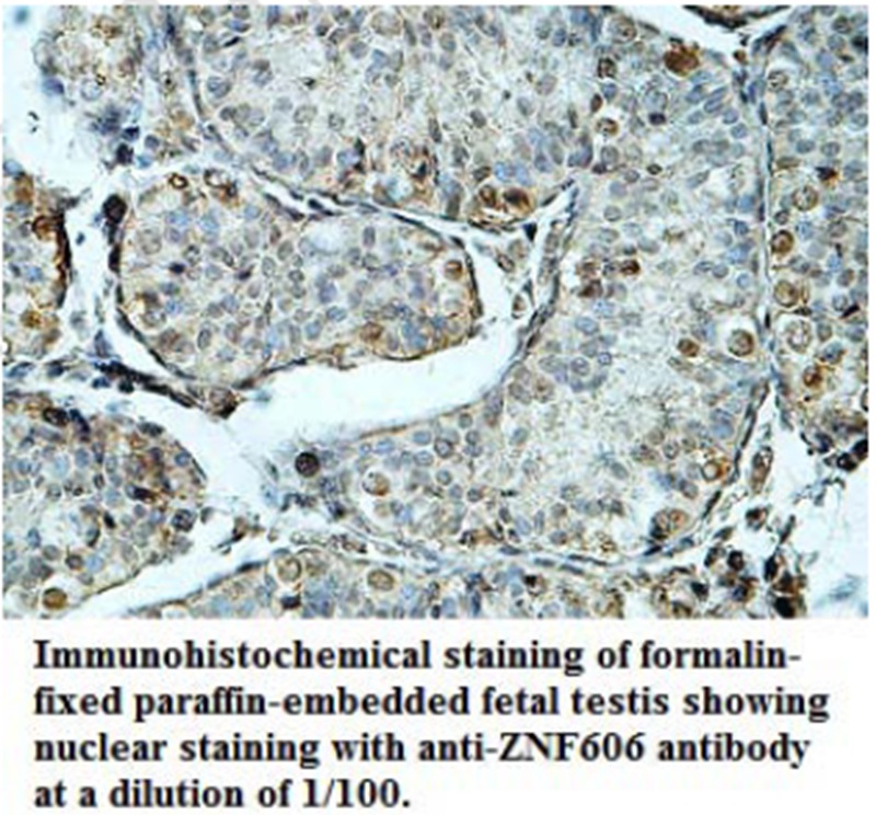 Anti-ZNF606 Antibody