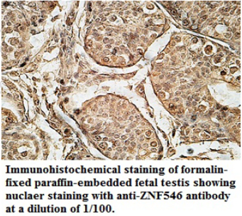 Anti-ZNF546 Antibody