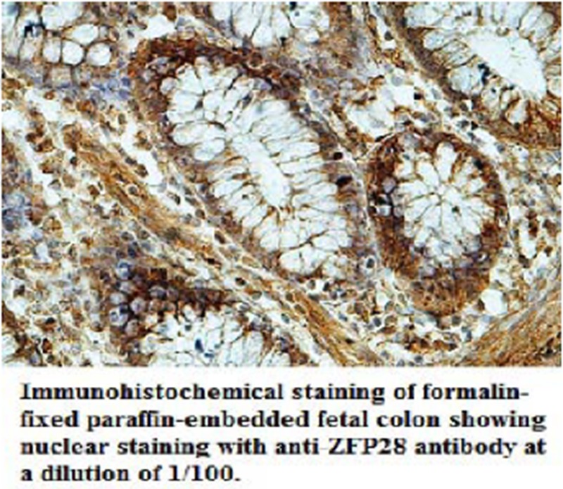 Anti-ZFP28 Antibody