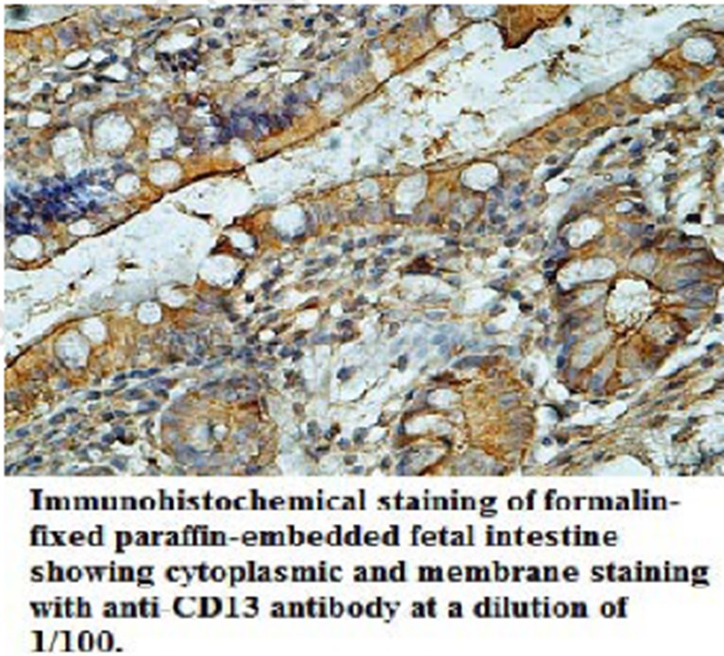 Anti-CD13 Antibody