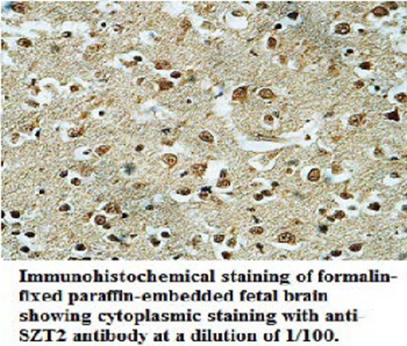 Anti-SZT2 Anibody Antibody