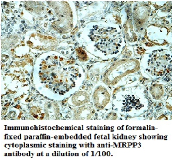 Anti-MRPP3 Antibody