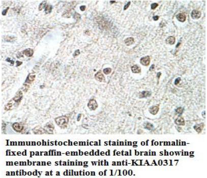 Anti-KIAA0317 Antibody