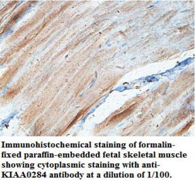Anti-KIAA0284 Antibody