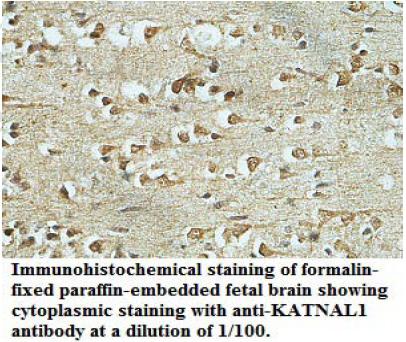 Anti-KATNAL1 Antibody