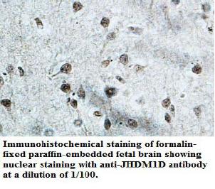 Anti-JHDM1D Antibody
