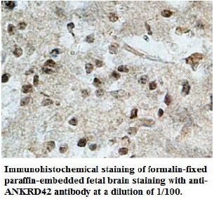 Anti-ANKRD42 Antibody