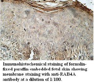 Anti-RAB4A Antibody