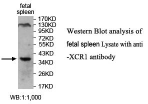 Anti-XCR1 Antibody