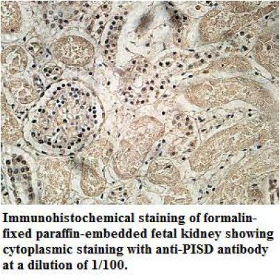 Anti-PISD Antibody