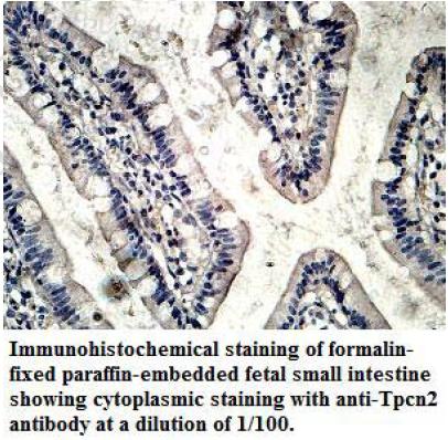 Anti-TPCN2 Antibody