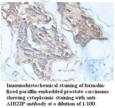 Anti-AIBZIP Antibody