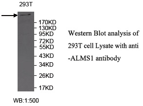 Anti-ALMS1 Antibody