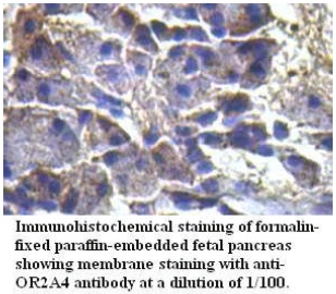Anti-OR2A4 Antibody