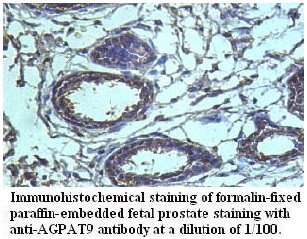 Anti-AGPAT9 Antibody