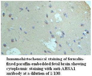 Anti-AHSA1 Antibody