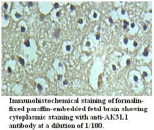 Anti-AK3L1 Antibody
