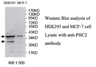 Anti-PHC2 Antibody