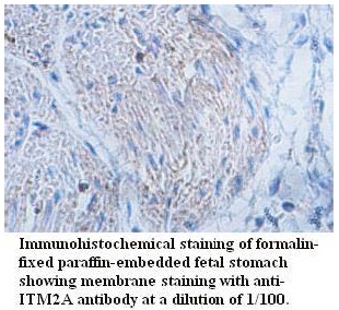 Anti-ITM2A Antibody