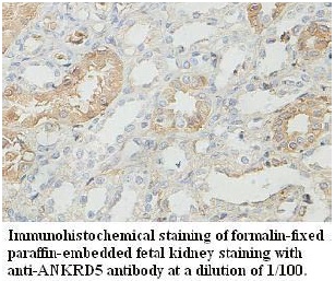 Anti-ANKRD5 Antibody