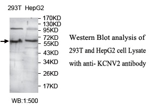 Anti-KCNV2 Antibody