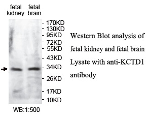 Anti-KCTD1 Antibody