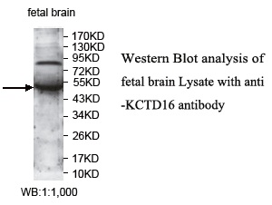 Anti-KCTD16 Antibody