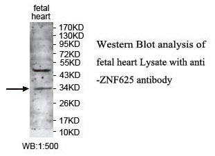 Anti-ZNF625 Antibody
