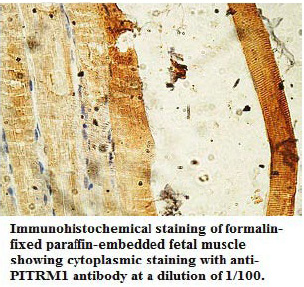 Anti-PITRM1 Antibody