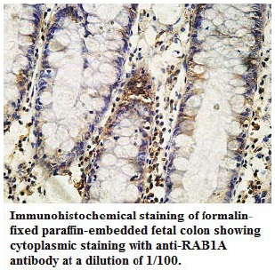 Anti-RAB1A Antibody
