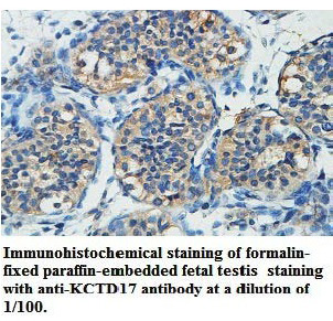Anti-KCTD17 Antibody