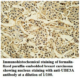 Anti-UBE3A Antibody