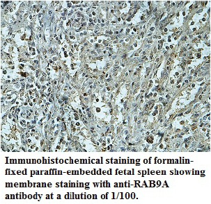 Anti-RAB9A Antibody