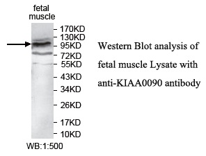 Anti-KIAA0090 Antibody