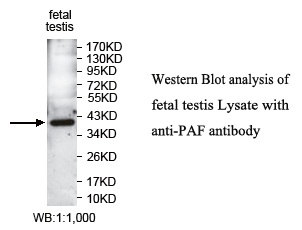 Anti-PAF Antibody