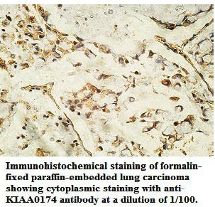 Anti-KIAA0174 Antibody