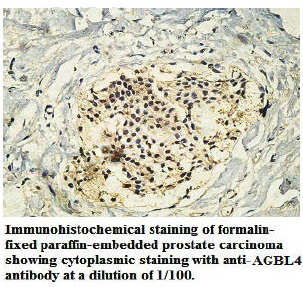 Anti-AGBL4 Antibody