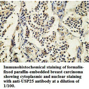 Anti-USP25 Antibody