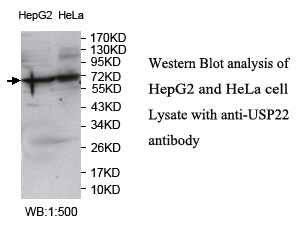 Anti-USP22 Antibody