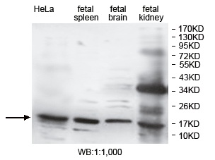 Anti-DUSP3 Antibody