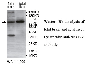 Anti-NFKBIZ Antibody