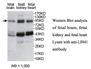 Anti-LIN41 Antibody
