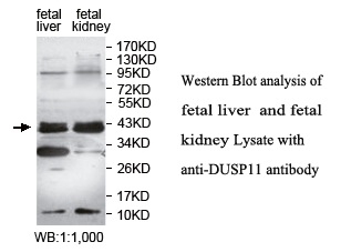 Anti-DUSP11 Antibody