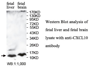 Anti-CXCL10 Antibody