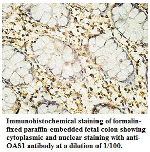 Anti-OAS1 Antibody