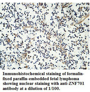 Anti-ZNF701 Antibody