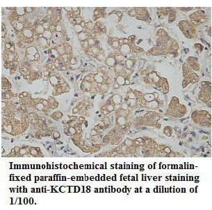 Anti-KCTD18 Antibody